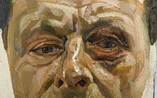 黑眼睛的自画像 Self-Portrait with Black Eye (c.1978)，卢西安·弗洛伊德