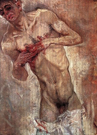 出血 Bleeding (1911)，马克斯·奥本海默